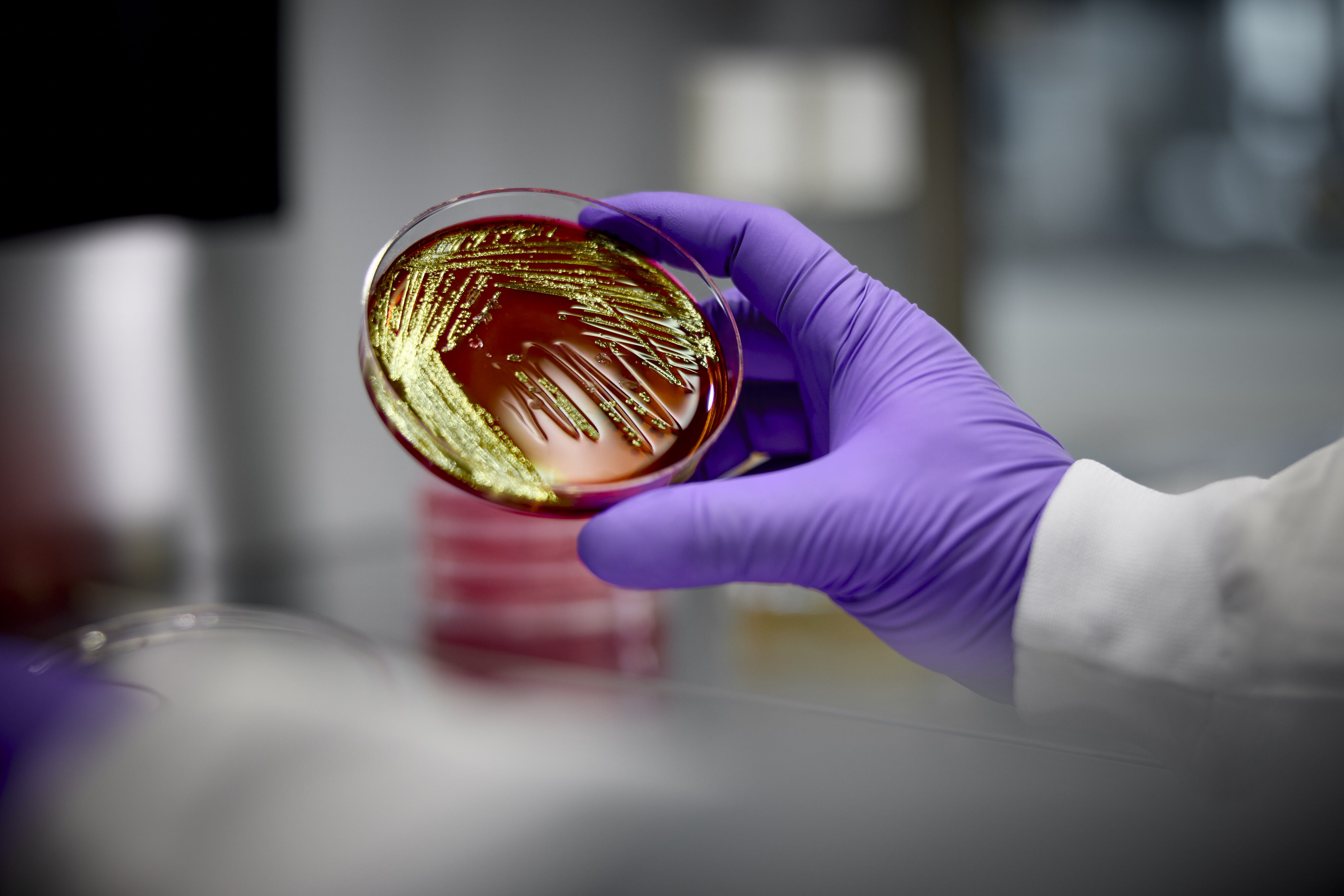 A gloved hand holds a petri dish with gold-colored bacterial colonies on a reddish-brown medium, suggesting a laboratory experiment.
